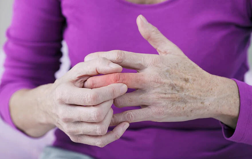 Ways to Treat a Sprained Finger | Hampton Adams